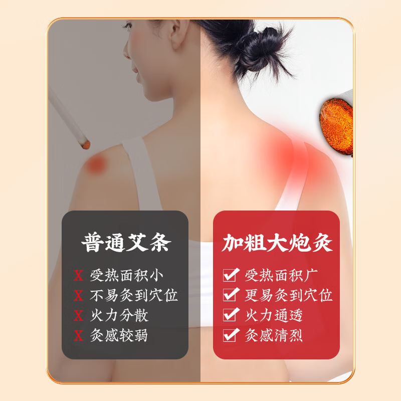 【中国直邮，时效5-12天】同仁堂 北京同仁堂艾条大炮灸艾条柱加粗雷火灸家用全身用陈年艾条艾柱艾绒条热敷调理养生手推式纯艾草条7cm-2条装