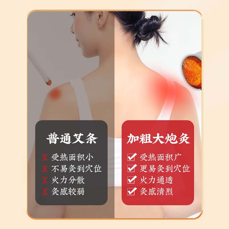 【中国直邮，时效5-12天】同仁堂 北京同仁堂艾条大炮灸艾条柱加粗雷火灸家用全身用陈年艾条艾柱艾绒条热敷调理养生手推式纯艾草条7cm-2条装