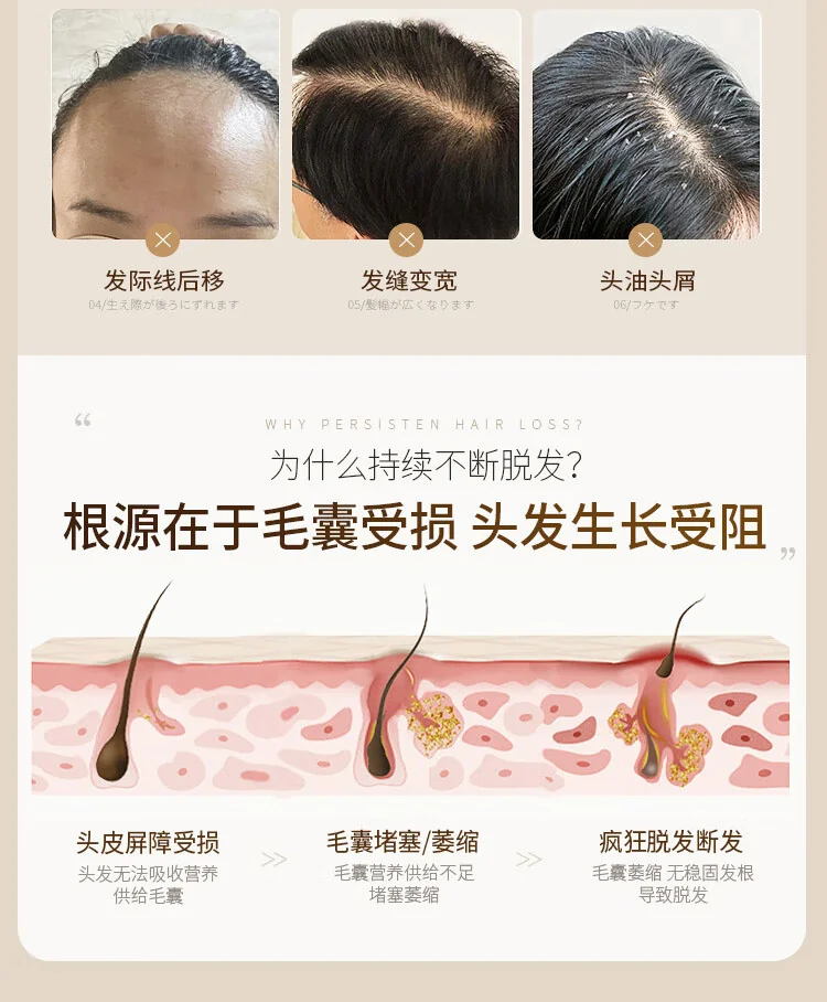 【中国直邮，时效10-15天】上海药皂 首乌再新洗发皂60g 去油健发 洗头蓬松 无皂基（2个装） detail image 3