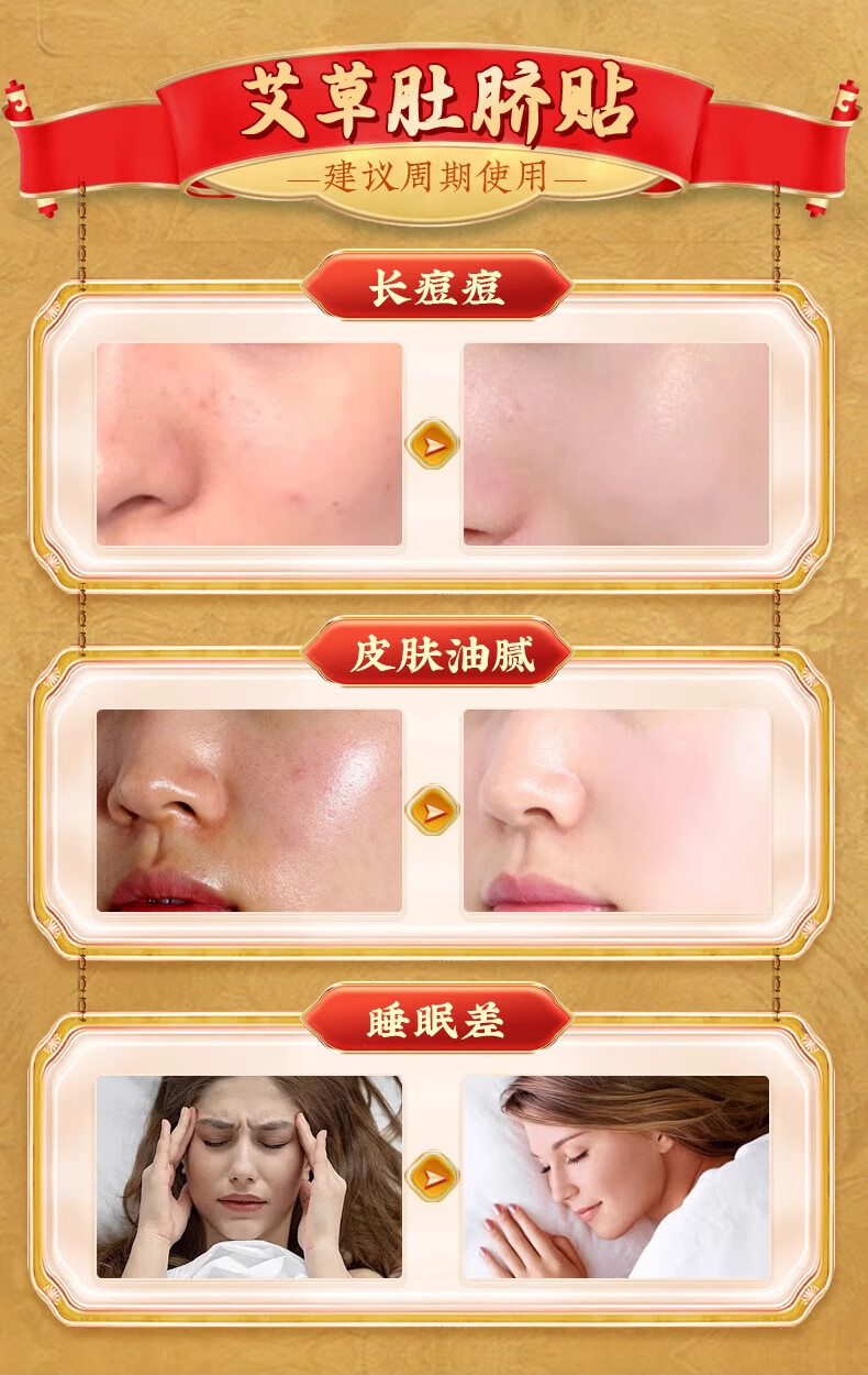 北京同仁堂,tongrentang，艾草肚脐贴,艾灸帖,祛湿排毒艾脐大肚子懒人贴
